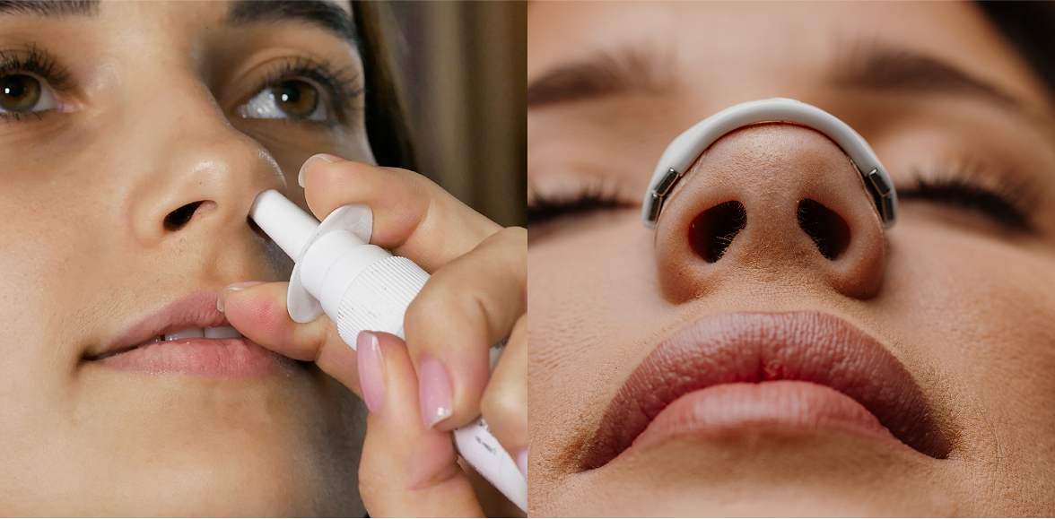 Nasal Strips vs. Nasal Sprays: Which Is Better for Congestion and Snoring?