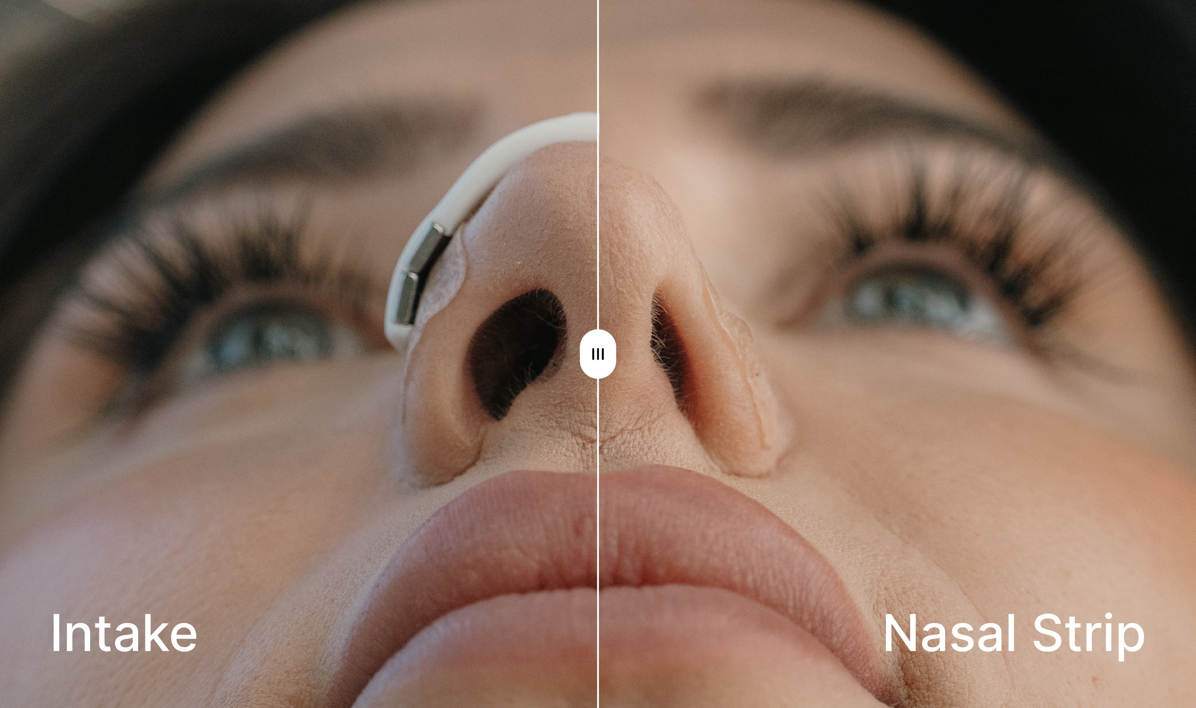 Magnetic Nasal Strips Allergy Drug-free decongestion