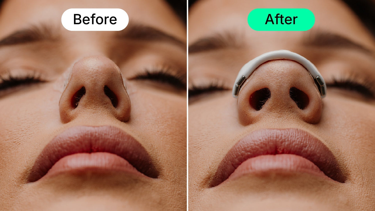 Instant Relief with Intake Magnetic Nasal Strip